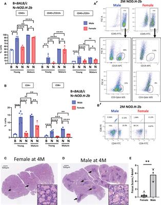 Spatial transcriptomics of the lacrimal gland features macrophage activity and epithelium metabolism as key alterations during chronic inflammation